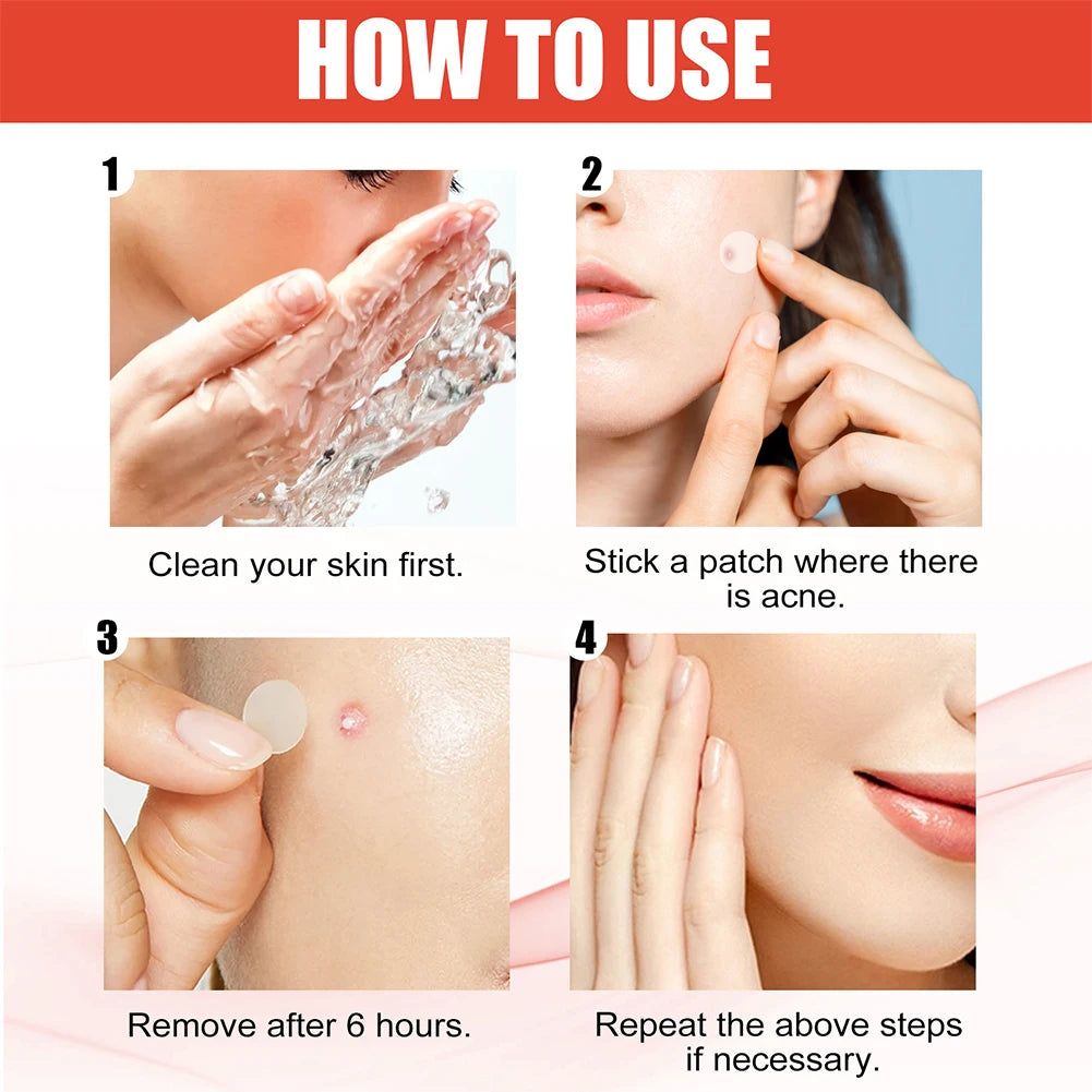 144pcs/set Face Skin Care Acne Pimple Patch 2 Sizes Invisible Professional Healing Absorbing Spot Sticker