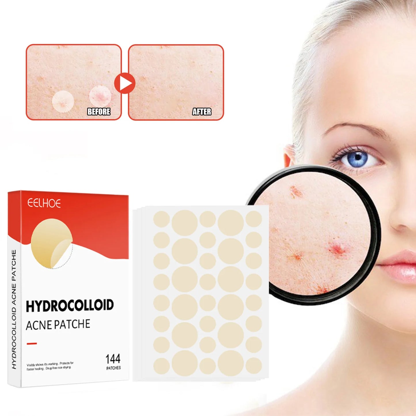 144pcs/set Face Skin Care Acne Pimple Patch 2 Sizes Invisible Professional Healing Absorbing Spot Sticker