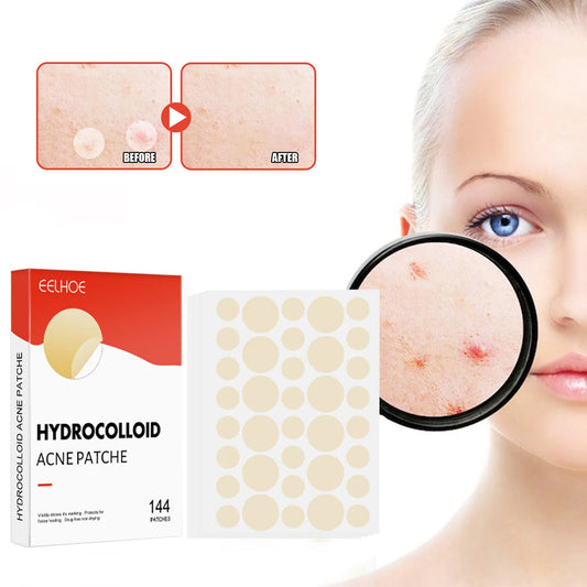 144pcs/set Face Skin Care Acne Pimple Patch 2 Sizes Invisible Professional Healing Absorbing Spot Sticker