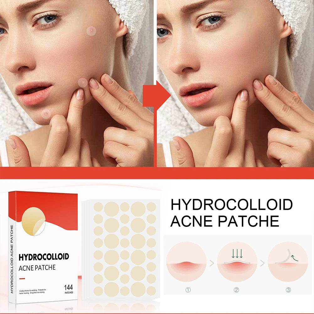 144pcs/set Face Skin Care Acne Pimple Patch 2 Sizes Invisible Professional Healing Absorbing Spot Sticker