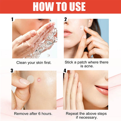 144pcs/set Face Skin Care Acne Pimple Patch 2 Sizes Invisible Professional Healing Absorbing Spot Sticker